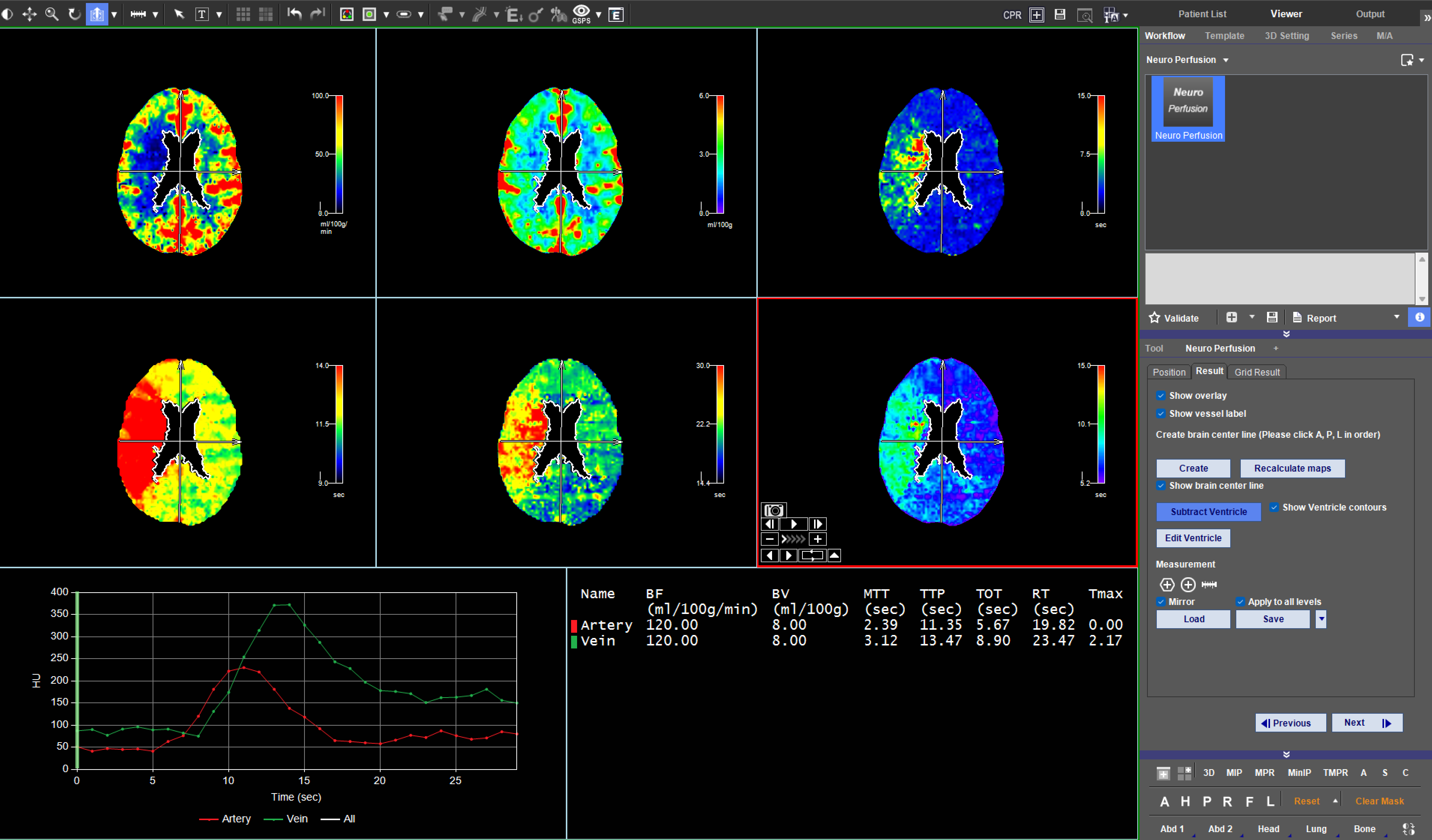 neuro
